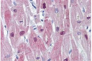 Human Heart: Formalin-Fixed, Paraffin-Embedded (FFPE) (HSPB6 antibody)