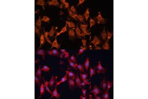Immunofluorescence analysis of C6 cells using HSD17B1 Polyclonal Antibody (ABIN6129829, ABIN6142002, ABIN6142003 and ABIN6215013) at dilution of 1:100 (40x lens). (HSD17B1 antibody  (AA 1-328))