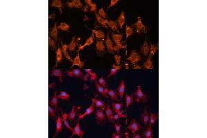 Immunofluorescence analysis of C6 cells using HSD17B1 Polyclonal Antibody (ABIN6129829, ABIN6142002, ABIN6142003 and ABIN6215013) at dilution of 1:100 (40x lens). (HSD17B1 antibody  (AA 1-328))