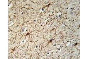 GFAP antibody immunohistochemistry analysis in formalin fixed and paraffin embedded human brain tissue. (GFAP antibody)