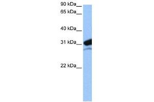 WB Suggested Anti-MRPL24 Antibody Titration:  0. (MRPL24 antibody  (N-Term))