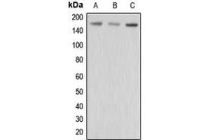Western blot analysis of MRP3 expression in HepG2 (A), MCF7 (B), MDAMB435 (C) whole cell lysates. (ABCC3 antibody  (Center))
