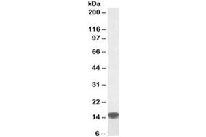 Western blot testing of human peripheral mononucleocytes lysate with S100A9 antibody at 0. (S100A9 antibody)