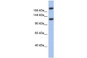 WB Suggested Anti-CACNA1I Antibody Titration: 0. (CACNA1I antibody  (Middle Region))
