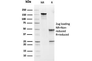 SDS-PAGE Analysis Purified MSH6 Mouse Monoclonal Antibody (MSH6/3091).