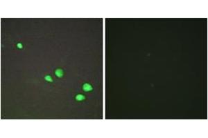 Immunofluorescence analysis of HepG2 cells, using CHD4 Antibody. (CHD4 antibody  (AA 571-620))