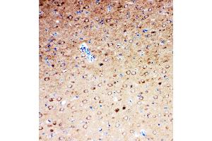 Anti-Serotonin transporter antibody, IHC(P) IHC(P): Rat Brain Tissue (SLC6A4 antibody  (N-Term))