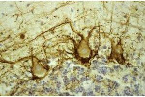 Immunostaining of human cerebellar cortex showing labeling of NF-H (brown) in basket cell axons surrounding the large Purkinje neurons. (NEFH antibody)