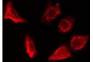 ABIN6278325 staining HepG2 cells by IF/ICC. (ERAP1 antibody  (Internal Region))
