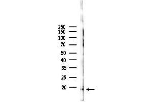 Western blot analysis of lysates from Mouse liver, using Phospho-4E-BP1 (Thr36) Antibody at 1/1000 dilution.