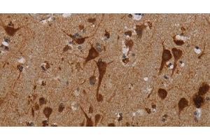 Immunohistochemistry of paraffin-embedded Human brain tissue using KMT2D Polyclonal Antibody at dilution 1:40 (Lysine (K)-Specific Methyltransferase 2B (KMT2B) antibody)