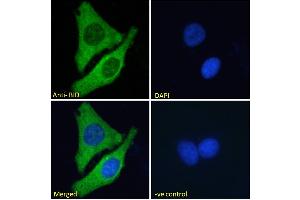 ABIN185380 Immunofluorescence analysis of paraformaldehyde fixed MCF7 cells, permeabilized with 0.