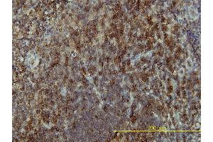 Immunoperoxidase of monoclonal antibody to LAT on formalin-fixed paraffin-embedded human tonsil tissue. (LAT antibody  (AA 1-233))