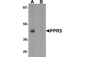 Western blot analysis of PRR5 in SK-N-SH cell lysate with PRR5 antibody at 1 µg/mL in (A) the absence and (B) the presence of blocking peptide (PRR5 antibody  (C-Term))