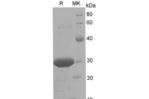 Western Blotting (WB) image for HLA-DR-gamma (CD74) (Active) protein (His tag) (ABIN7320931) (CD74 Protein (His tag))
