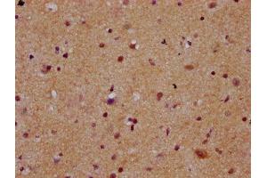 IHC image of ABIN7168374 diluted at 1:300 and staining in paraffin-embedded human brain tissue performed on a Leica BondTM system. (MEX3B antibody  (AA 253-375))