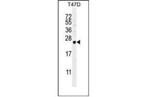 Western blot analysis of GAGE12B Antibody (N-term) in T47D cell line lysates (35ug/lane). (G Antigen 12B antibody  (N-Term))