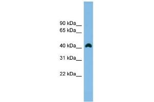 WB Suggested Anti-ANKRD42 Antibody Titration: 0. (ANKRD42 antibody  (N-Term))