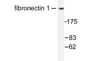 Image no. 1 for anti-Fibronectin antibody (ABIN272101) (Fibronectin antibody)