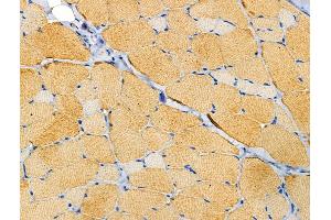 ABIN6258681 and ABIN6274241 at 1/100 staining Rat skin tissue by IHC-P. (ACTN2/3 antibody  (N-Term))