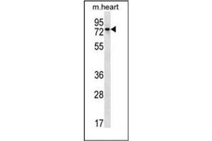 Western blot analysis of PARP2 Antibody (C-term) in mouse heart tissue lysates (35ug/lane). (PARP2 antibody  (C-Term))