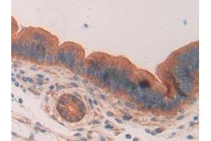 Immunohistochemistry (IHC) image for anti-Mucin 1 (MUC1) (AA 410-525) antibody (ABIN7440383)