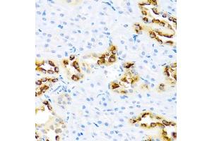 Immunohistochemistry of paraffin-embedded rat kidney using KLK11 antibody (ABIN6129403, ABIN6142946, ABIN6142948 and ABIN6216242) at dilution of 1:100 (40x lens). (Kallikrein 11 antibody  (AA 1-250))