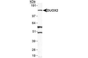 DUOX2 antibody  (AA 400-500)