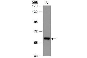 WB Image Sample(30 ug whole cell lysate) A:Hep G2, 7. (ALDH6A1 antibody)