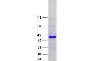 Validation with Western Blot (PQBP1 Protein (Transcript Variant 4) (Myc-DYKDDDDK Tag))