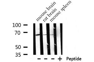 Western blot analysis of  RPA1 expression in various lysates (RPA1 antibody  (Internal Region))