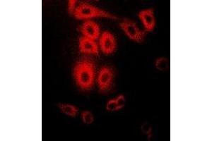 Immunofluorescent analysis of Telethonin staining in Hela cells. (TCAP antibody)