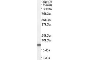 ABIN185573 (1µg/ml) staining of Human Testis Lysate (35µg protein in RIPA buffer). (Stathmin 1 antibody  (C-Term))