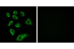 Peptide - +Immunohistochemistry analysis of paraffin-embedded human liver carcinoma tissue using Cytochrome P450 2W1 antibody. (CYP2W1 antibody)