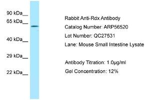 Western Blotting (WB) image for anti-Radixin (RDX) (C-Term) antibody (ABIN2786751) (Radixin antibody  (C-Term))