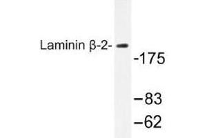 Image no. 1 for anti-Laminin, beta 2 (Laminin S) (LAMB2) antibody (ABIN317724) (LAMB2 antibody)