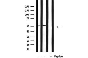 anti-6-phosphofructo-2-Kinase/fructose-2,6-Biphosphatase 1/4 (PFKFB1/4) antibody
