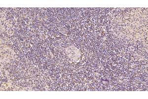 Detection of CDNF in Human Spleen Tissue using Monoclonal Antibody to Cerebral Dopamine Neurotrophic Factor (CDNF) (CDNF antibody  (AA 33-187))