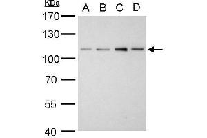 WB Image Alpha Actinin 2 antibody [N1N3] detects ACTN2 protein by western blot analysis. (ACTN2 antibody)