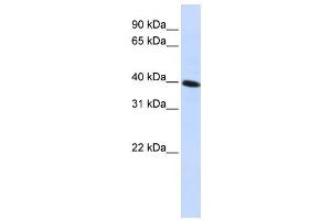 Western Blotting (WB) image for anti-FLJ10769 antibody (ABIN2459108) (FLJ10769 antibody)