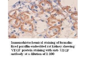 Immunohistochemistry (IHC) image for anti-Vascular Endothelial Growth Factor A (VEGFA) antibody (ABIN6583751) (VEGFA antibody)