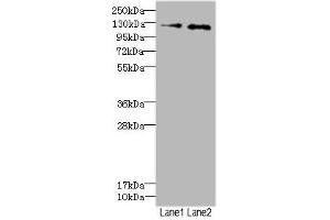 Western blot All lanes: HEPH antibody at 2.