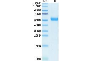 Human IL-5R alpha on Tris-Bis PAGE under reduced condition. (IL5RA Protein (AA 21-335) (His-Avi Tag))