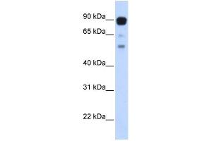 WB Suggested Anti-ZNF408 Antibody Titration:  0. (ZNF408 antibody  (Middle Region))