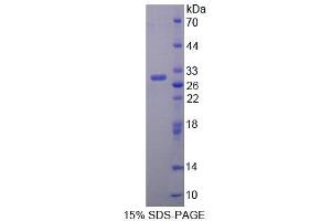 SDS-PAGE analysis of Rat BCAT1 Protein.