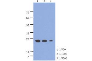 The cell lysates of HepG2 (40ug) were resolved by SDS-PAGE, transferred to PVDF membrane and probed with anti-human ADI1 antibody (1:500 ~ 1:1000).
