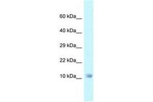 Image no. 1 for anti-NADH Dehydrogenase (Ubiquinone) 1 alpha Subcomplex, 6, 14kDa (NDUFA6) (C-Term) antibody (ABIN6747754) (NDUFA6 antibody  (C-Term))