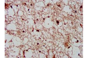 IHC image of ABIN7148847 diluted at 1:600 and staining in paraffin-embedded human brain tissue performed on a Leica BondTM system. (Cyclin-Dependent Kinase 11A (CDK11A) (AA 5-216) antibody)