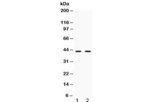 Western blot testing of 1) rat liver and 2) human HeLa lysate with NR2F6 antibody at 0. (NR2F6 antibody)