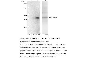 Western Blotting (WB) image for anti-E2F Transcription Factor 1 (E2F1) (pSer364) antibody (ABIN3201010) (E2F1 antibody  (pSer364))